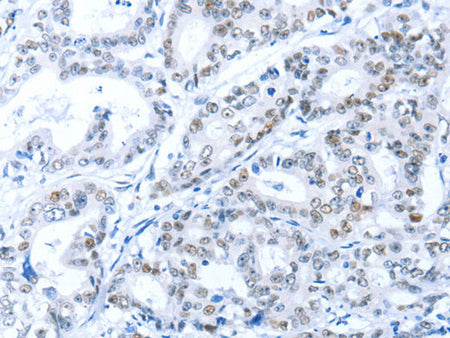 ARID1A Polyclonal Antibody Store at -20°C