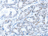 ARID1A Polyclonal Antibody Store at -20°C