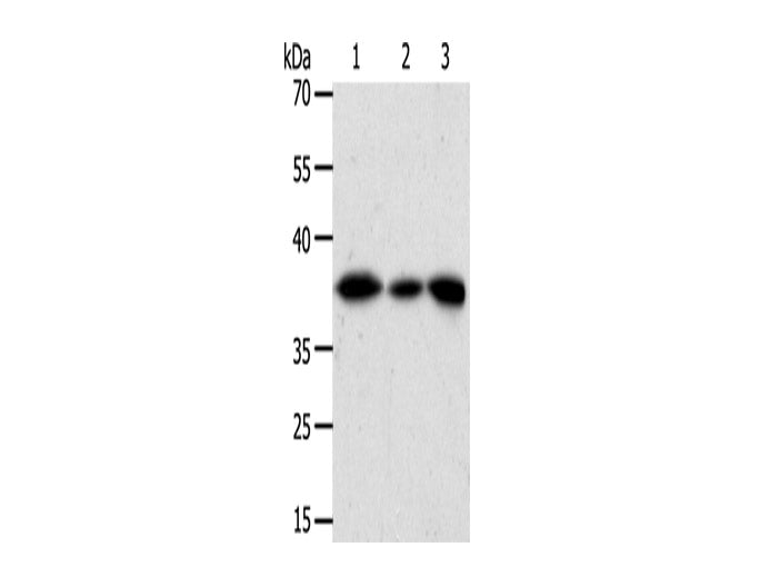 AKR1A1 Polyclonal Antibody Store at -20°C