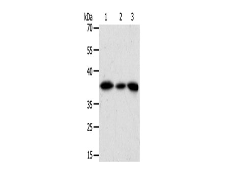 AKR1A1 Polyclonal Antibody Store at -20°C