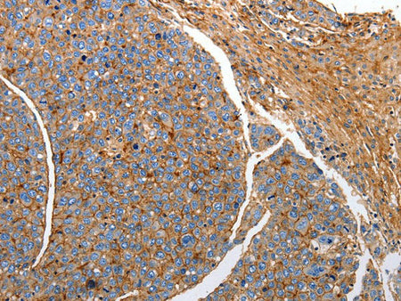 CD151 Polyclonal Antibody Store at -20°C