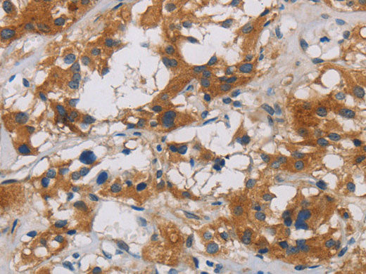 CNDP1 Polyclonal Antibody Store at -20°C