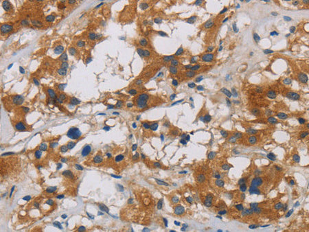 CNDP1 Polyclonal Antibody Store at -20°C