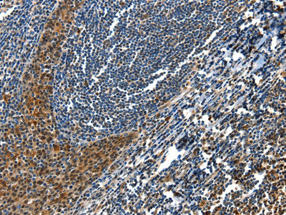 AQP2 Polyclonal Antibody Store at -20°C