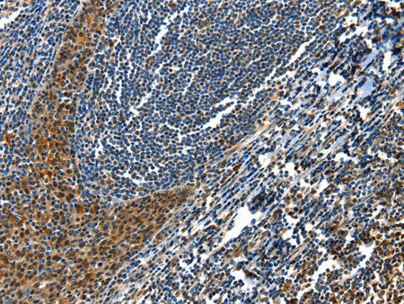 AQP2 Polyclonal Antibody Store at -20°C