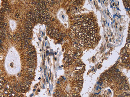 ERCC6L Polyclonal Antibody Store at -20°C