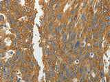 RPLP0 Polyclonal Antibody Reactivity Human, Mouse, Rat