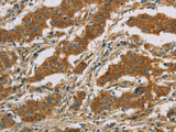 CYP39A1 Polyclonal Antibody Store at -20°C