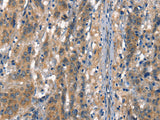 VE-Cadherin Polyclonal Antibody
