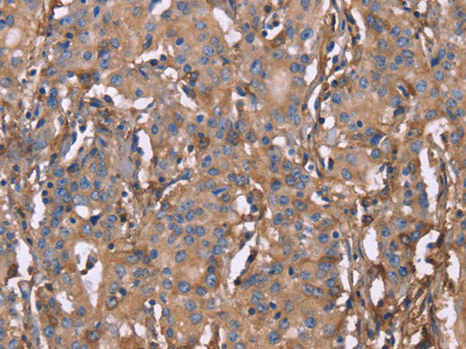 HP Polyclonal Antibody Store at -20°C
