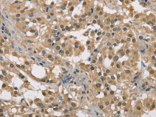 DACH2 Polyclonal Antibody Store at -20°C