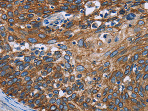 FCGR3A Polyclonal Antibody Store at -20°C