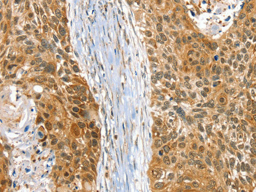 RAB27A Polyclonal Antibody Store at -20°C