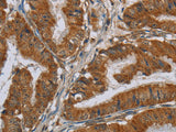 CSH1 Polyclonal Antibody Store at -20°C