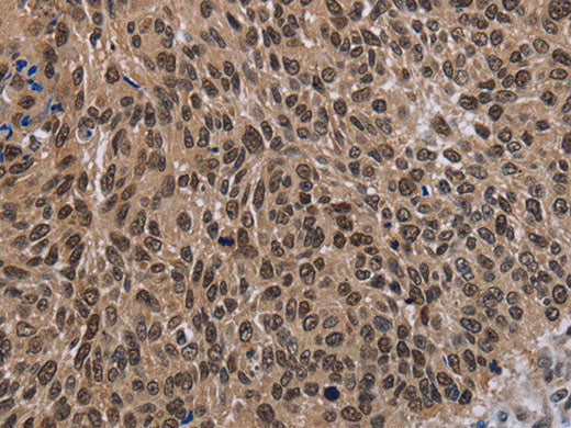 DLX4 Polyclonal Antibody Store at -20°C