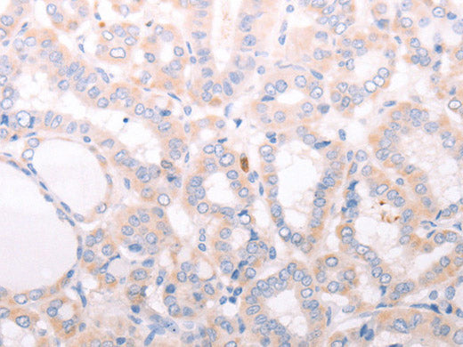 ANKRA2 Polyclonal Antibody