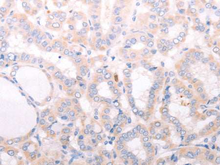 ANKRA2 Polyclonal Antibody