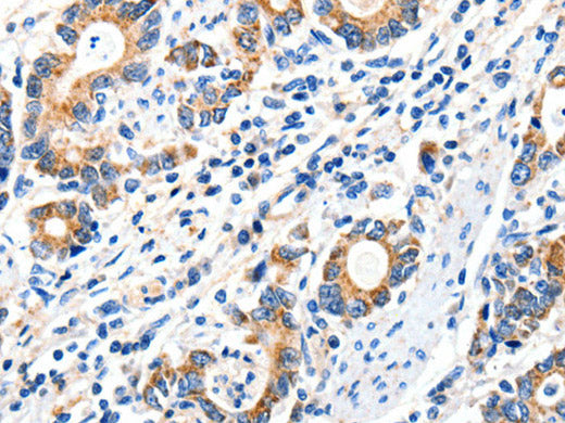 GluR2 Polyclonal Antibody Store at -20°C