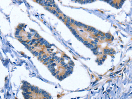 IBSP Polyclonal Antibody Store at -20°C