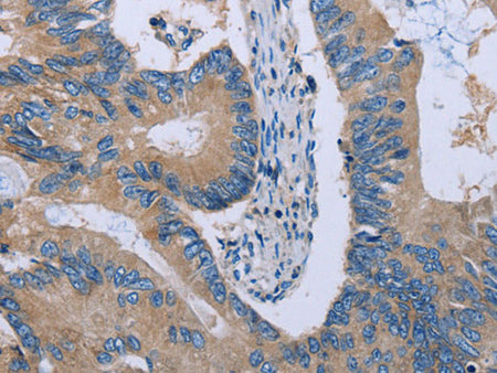 HYAL3 Polyclonal Antibody Store at -20°C