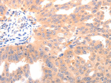 BGLAP Polyclonal Antibody Store at -20°C