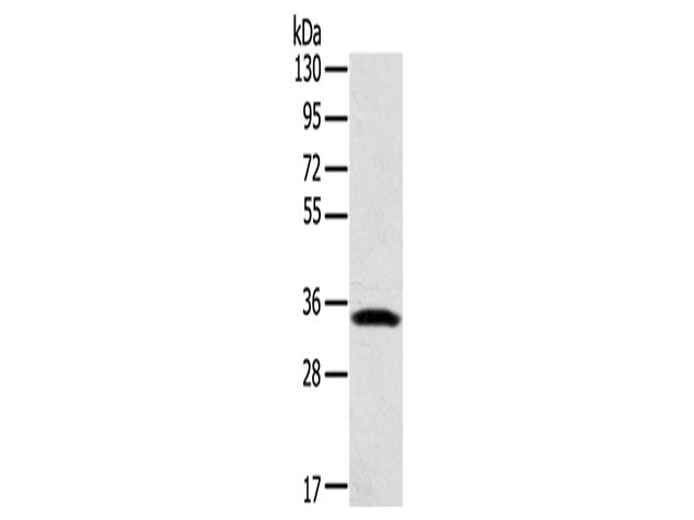 STX11 Polyclonal Antibody Store at -20°C