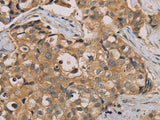 NANOS2 Polyclonal Antibody