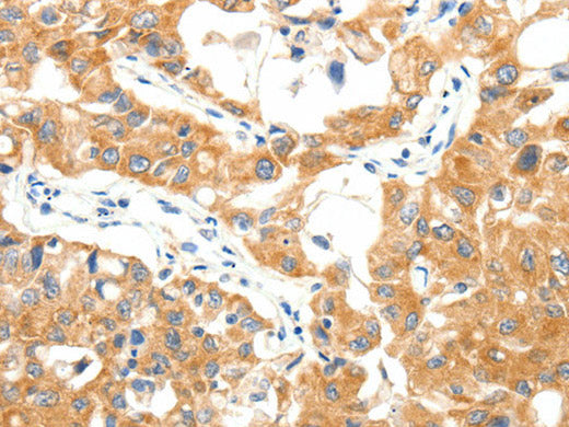TRAF3 Polyclonal Antibody Store at -20°C
