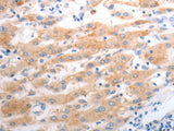 SLC22A6 Polyclonal Antibody