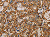 MTFR1 Polyclonal Antibody