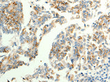 TRPC6 Polyclonal Antibody Store at -20°C