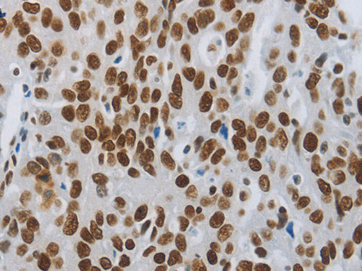 SLC16A14 Polyclonal Antibody