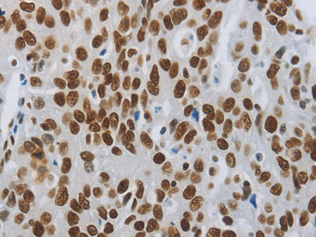 SLC16A14 Polyclonal Antibody