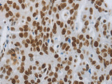 SLC16A14 Polyclonal Antibody