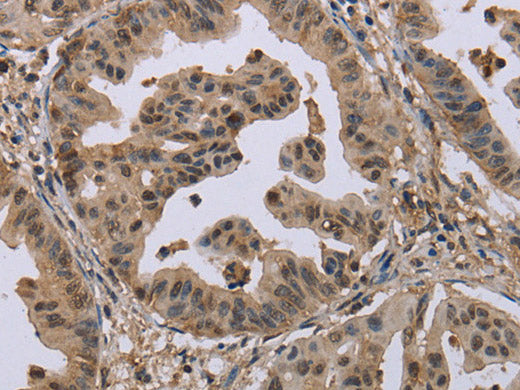 MCC Polyclonal Antibody Store at -20°C