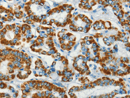 BCAT2 Polyclonal Antibody Store at -20°C