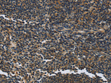 LGALS7 Polyclonal Antibody