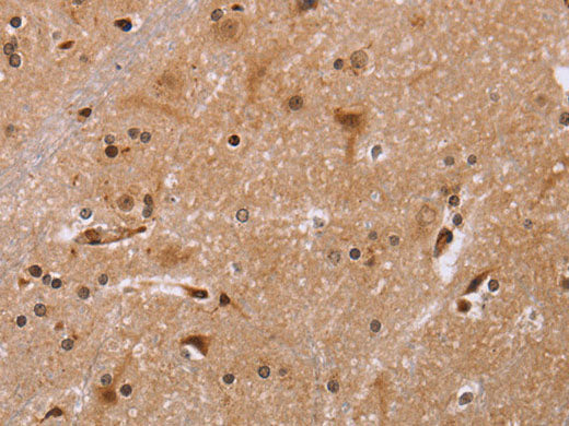 FBP2 Polyclonal Antibody Store at -20°C