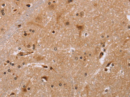 FBP2 Polyclonal Antibody Store at -20°C