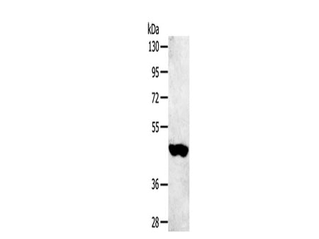 SULT2B1 Polyclonal Antibody Store at -20°C