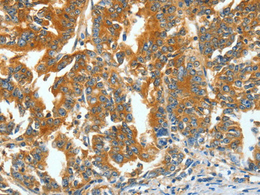 ASNS Polyclonal Antibody Store at -20°C