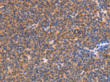 NES Polyclonal Antibody