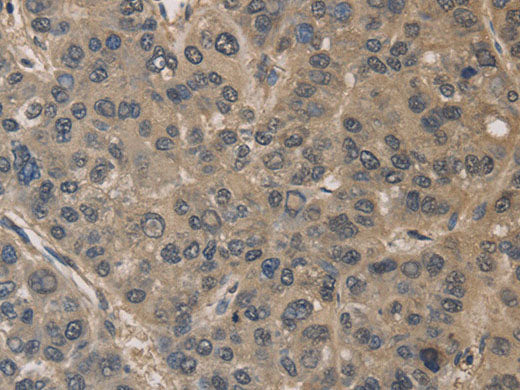 DRG1 Polyclonal Antibody Store at -20°C
