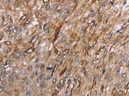 GRPR Polyclonal Antibody