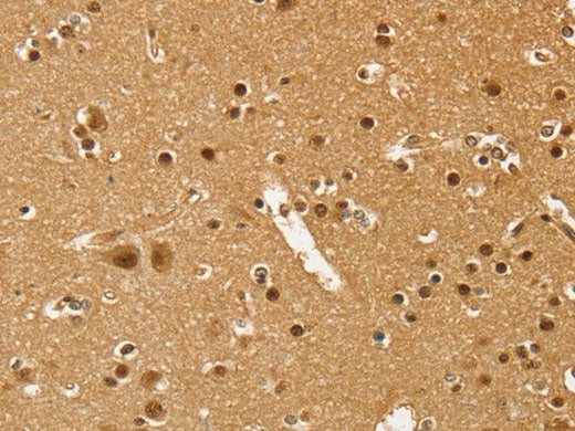 PSMC1 Polyclonal Antibody Store at -20°C