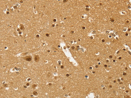 PSMC1 Polyclonal Antibody Store at -20°C