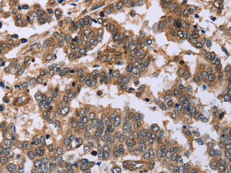 FAF1 Polyclonal Antibody Store at -20°C
