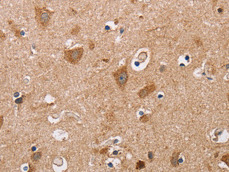 ALG9 Polyclonal Antibody Store at -20°C