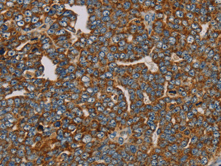 MRPL28 Polyclonal Antibody Store at -20°C