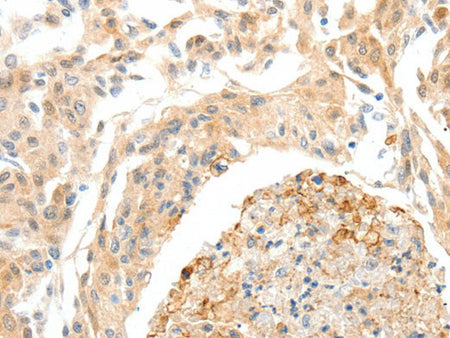 SEMA3D Polyclonal Antibody Store at -20°C